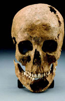 Skull of a fourteen- or fifteen-year-old boy, likely killed in 1607 by an Indian arrow at Jamestown.